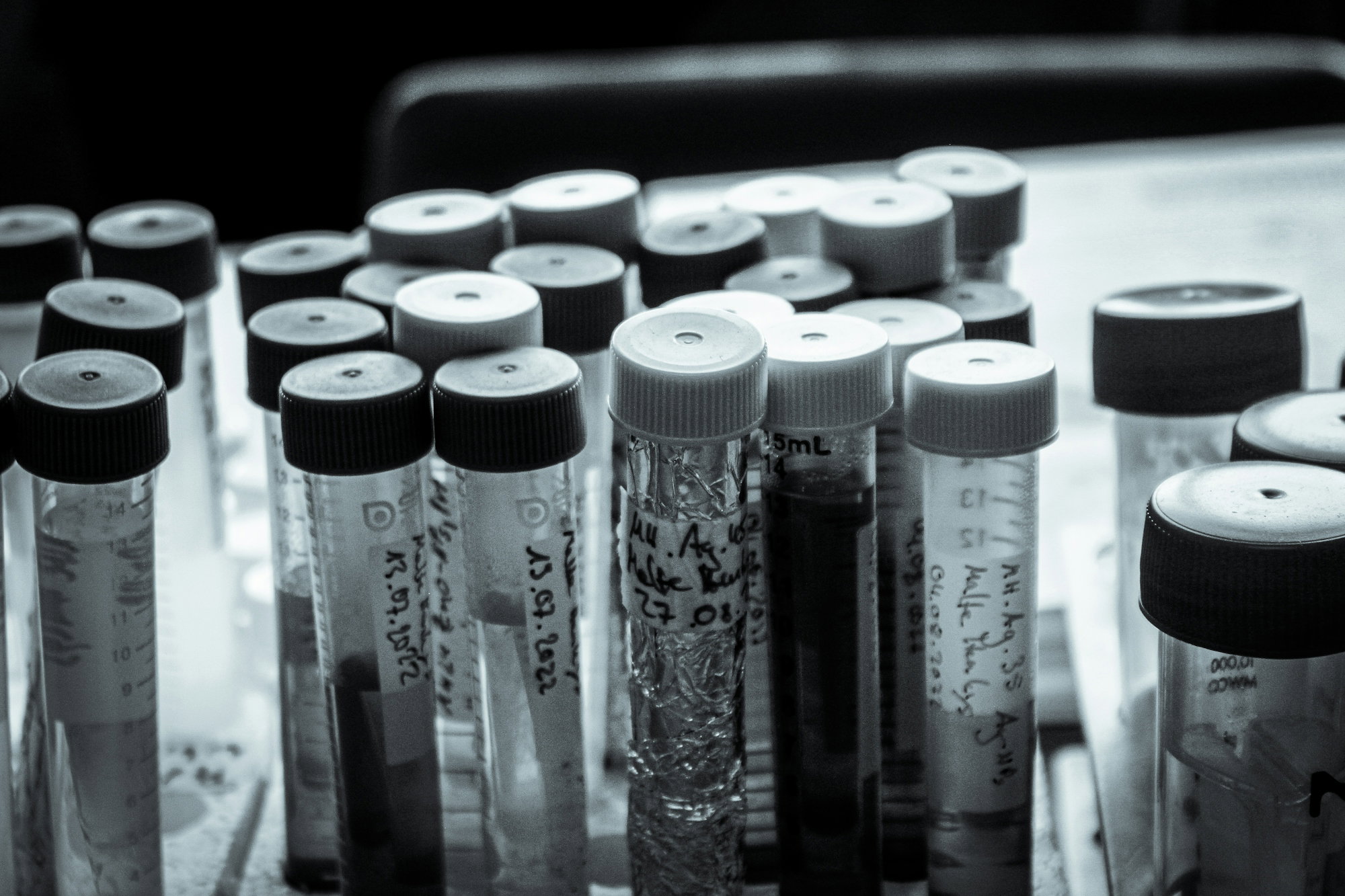 a-bunch-of-pens-sitting-on-top-of-a-table.jpg a bunch of pens sitting on top of a table